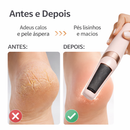Removedor de Calos Elétrico Feet Cleaner