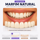 ProSmile NaturalFit™ — Faceta Dentária Ajustável