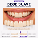 ProSmile NaturalFit™ — Faceta Dentária Ajustável